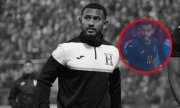 Futbolista de Honduras necesit&oacute; ox&iacute;geno tras jugar 31 minutos en la victoria de M&eacute;xico en Toluca